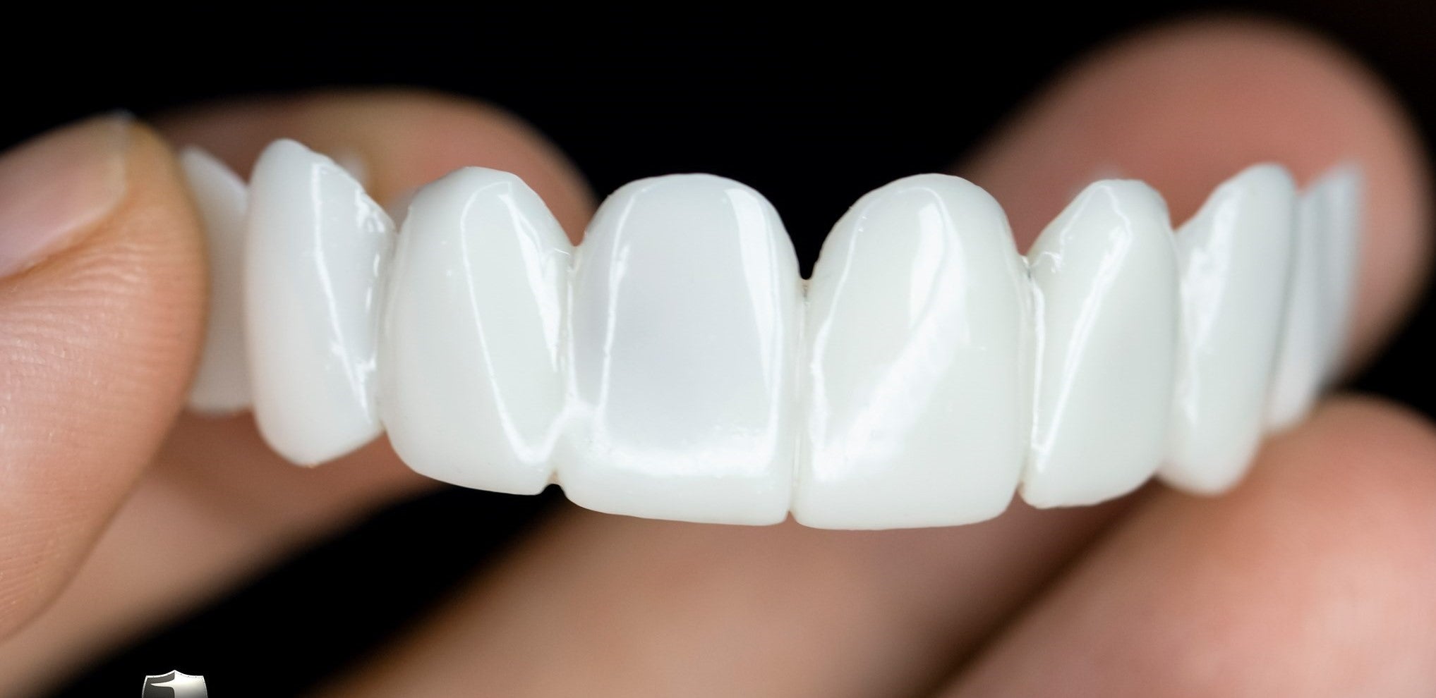 BrightGuard Veneers For Quick Flaw Coverage And A Brighter Smile