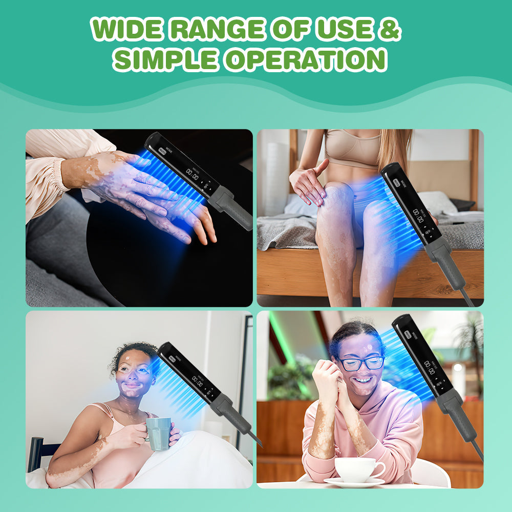 Kernel KN-4003BL Handheld UVB Light 311nm Lamp For Home Use