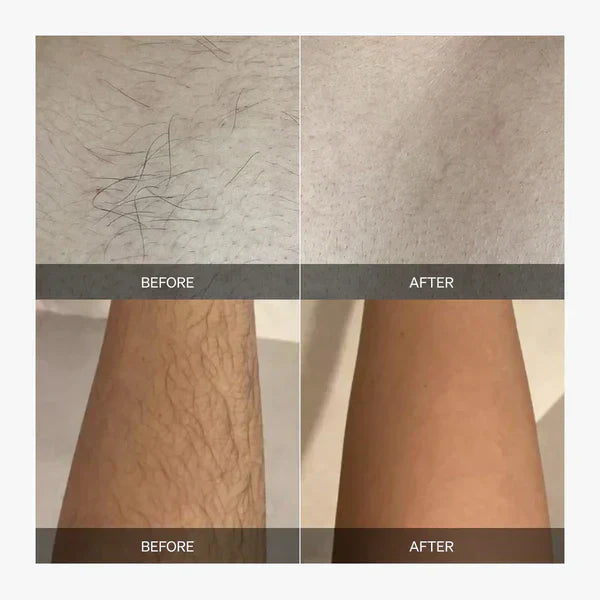 GlowPulse Hair Removal At Home Delivers Full Body Smoothness Without Irritation