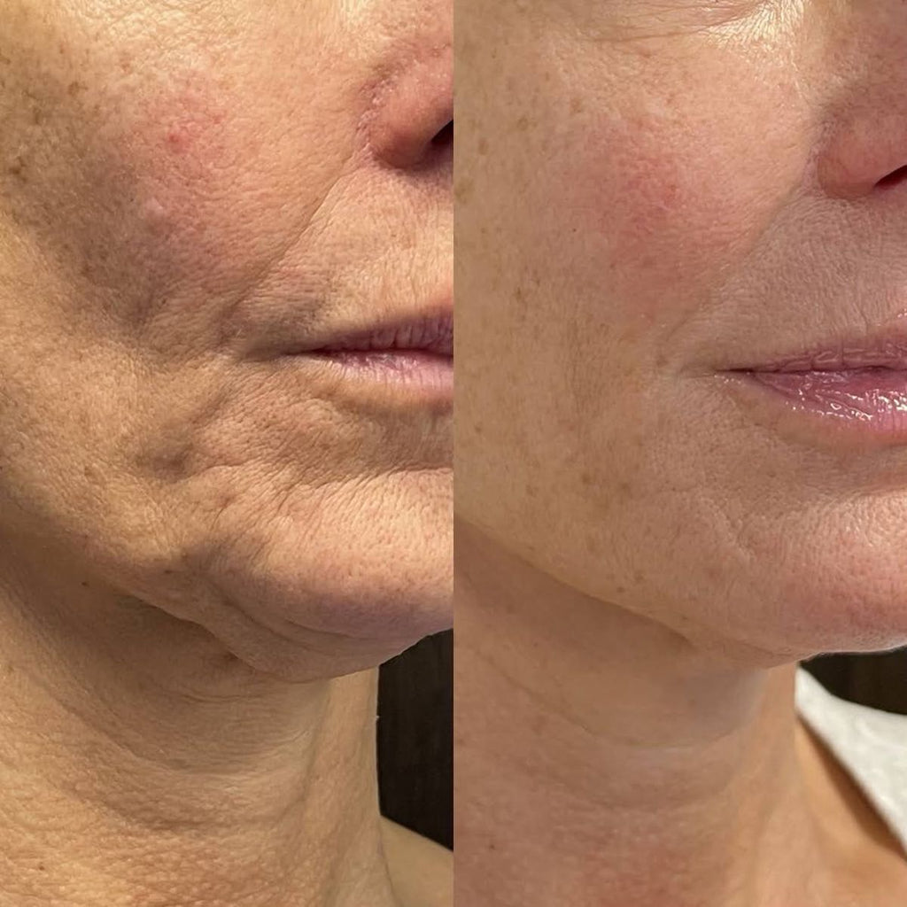 Nexa Serum Stick Everyday Skincare For Daily Use Routine