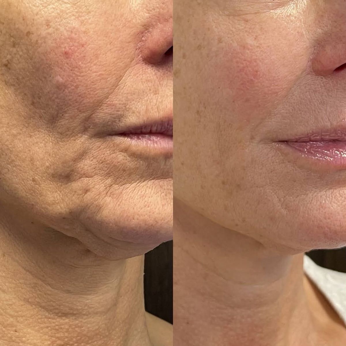 Nexa Serum Stick Everyday Skincare For Daily Use Routine