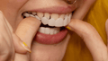 Snap-On Smile héjak azonnali, természetes hatású mosolyért