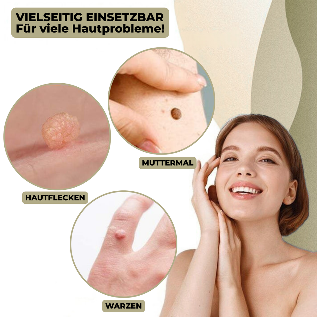 DermaLinx At-Home Skin Blemish Care Kit For Quick Home Use