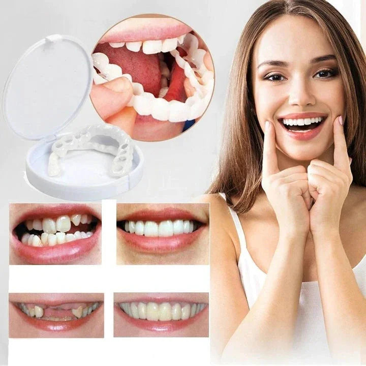 Instant Smile Transformation with Snap on Smile Veneers