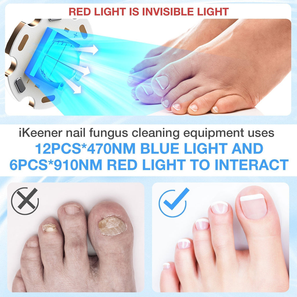 Toenail Light Therapy Device For At Home Nail Care