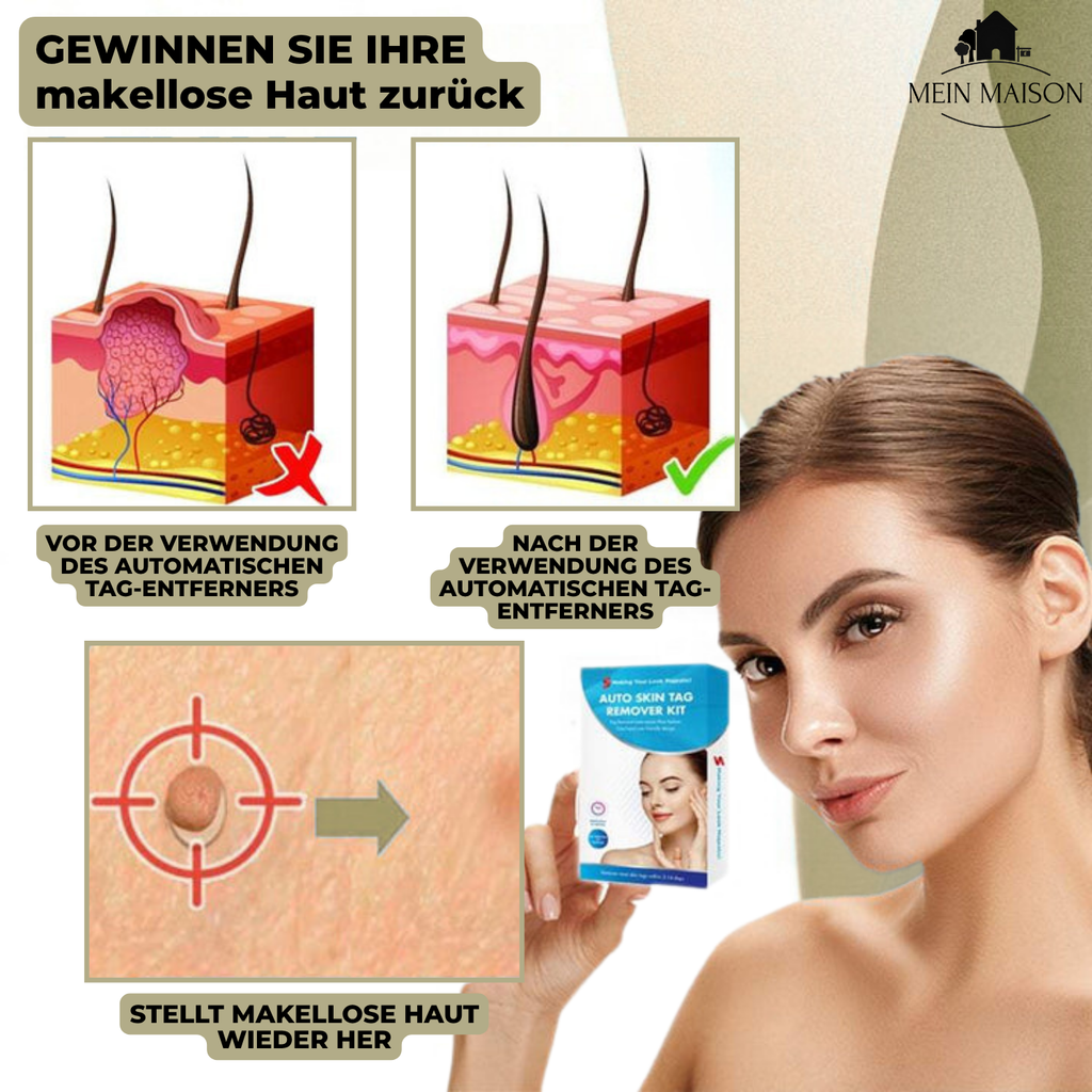 DermaLinx At-Home Skin Blemish Care Kit For Quick Home Use