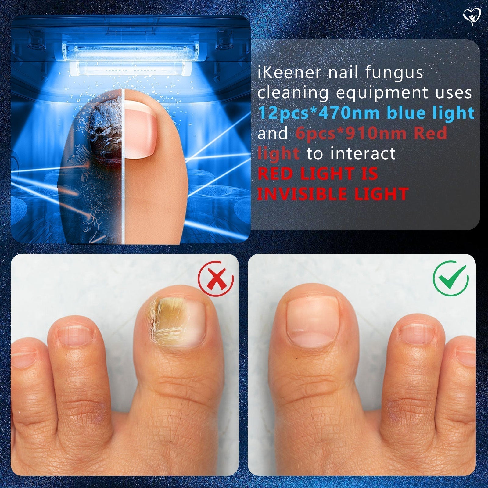 Multi Nail LED Light Therapy Device For Toenail Care