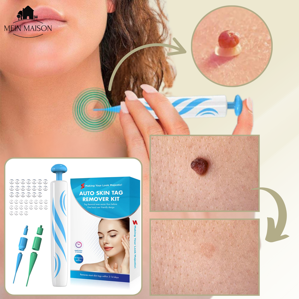 DermaLinx At-Home Skin Blemish Care Kit For Quick Home Use