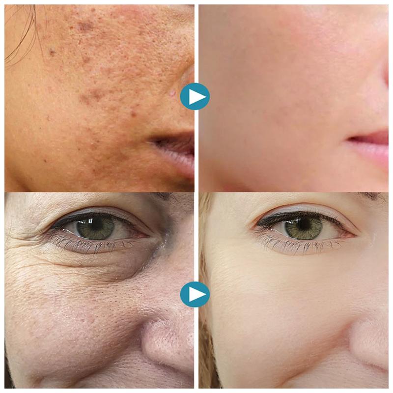 VeloraPores Korean Inspired Radiant Complexion Gel For Korean Beauty Fans