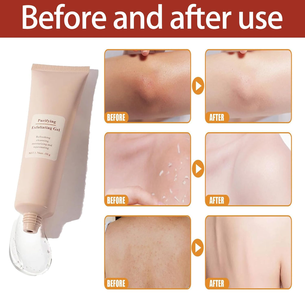 LumaGlow Sharpen Your Glow With Exfoliating Gel For Radiant Skin