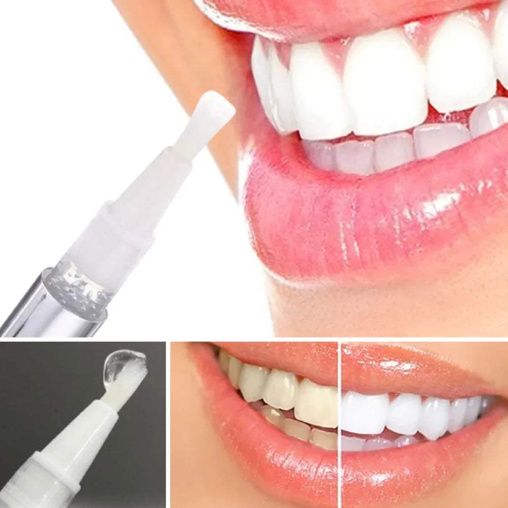 Stylo blanchisseur dentaire correcteur de couleur quotidien pour éclaircir les dents à la maison | Atiets