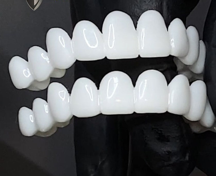 BrightGuard Veneers For Quick Flaw Coverage And A Brighter Smile