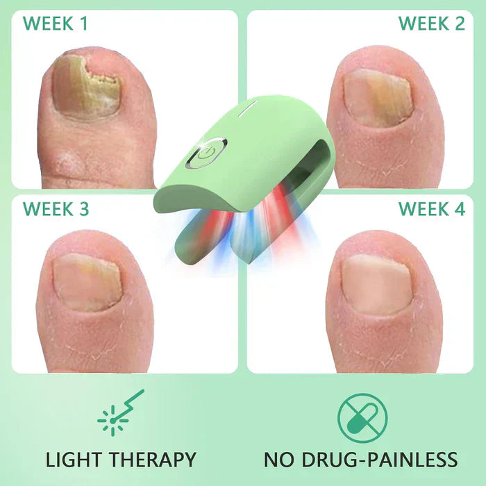 Toenail Fungus Laser Nail Care Device For Home Use