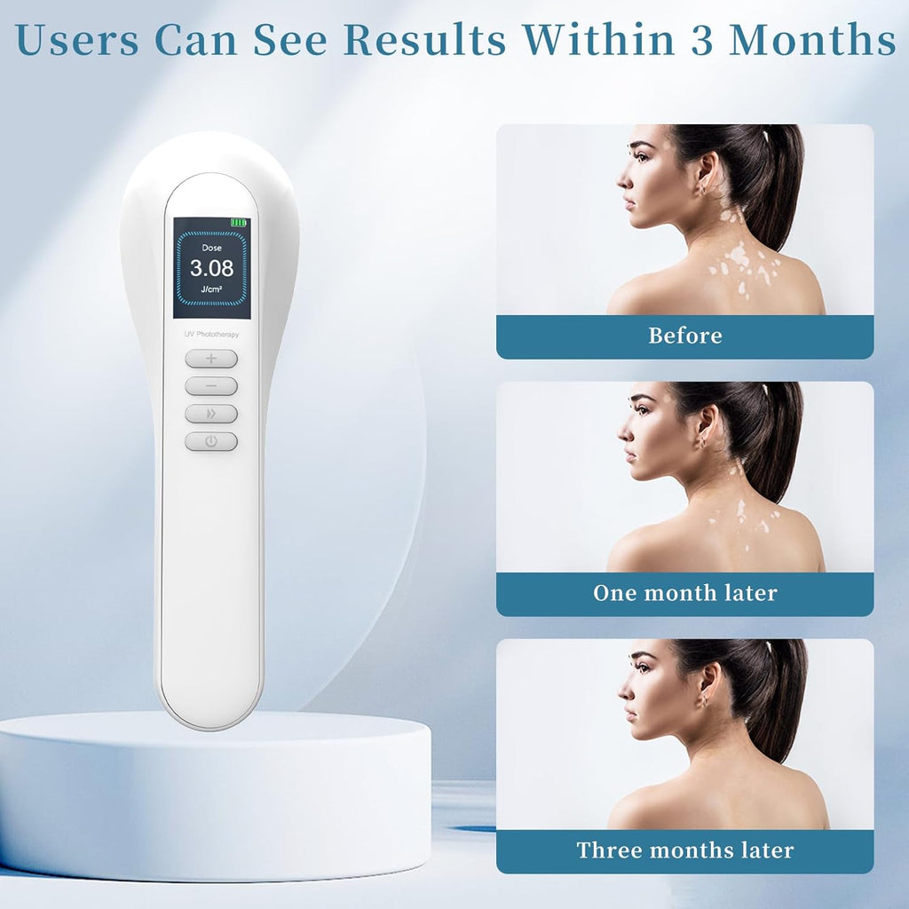 At Home 308 UV LED Lamp For Personal Home Use Device