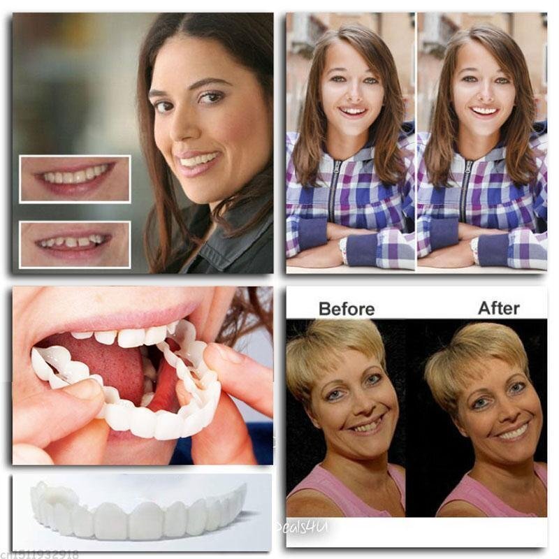 Snap-On Dentures Essentials kolekce pro každodenní nošení s možnostmi výměny