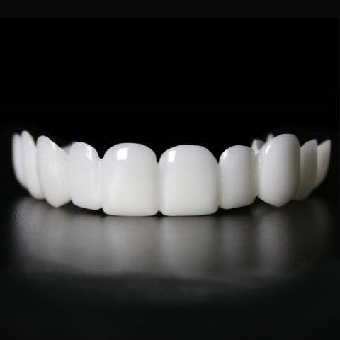 Instant Smile Transformation with Snap on Smile Veneers