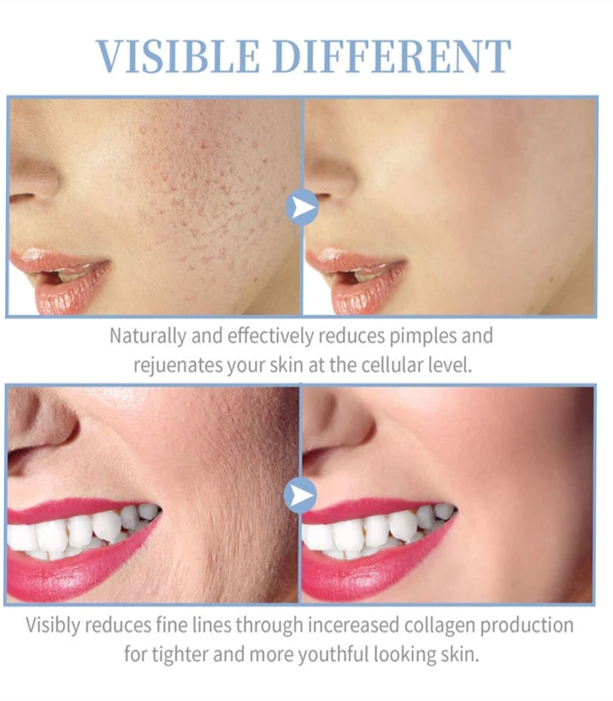 Varita Profesional para el Cuidado Avanzado de la Piel y Estética
