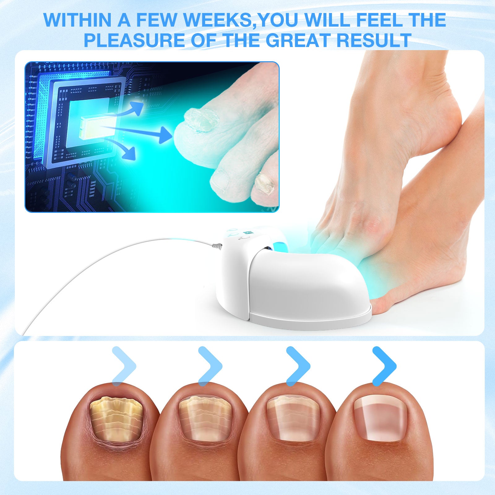 Toenail Light Therapy Device For At Home Nail Care