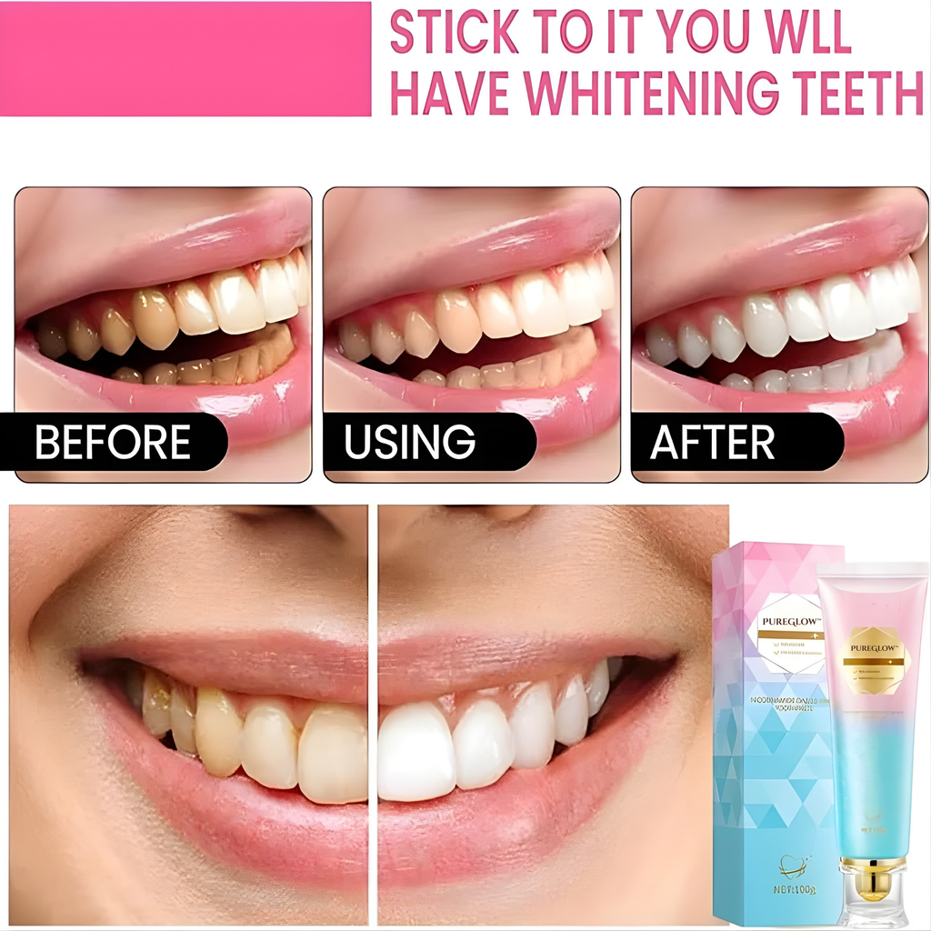 LumaBright Niacinamide Toothpaste For Quick Smile Brightening