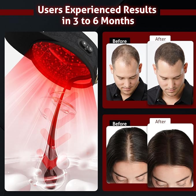 Cordless Cap With Laser Technology For Hair Growth At-Home Use
