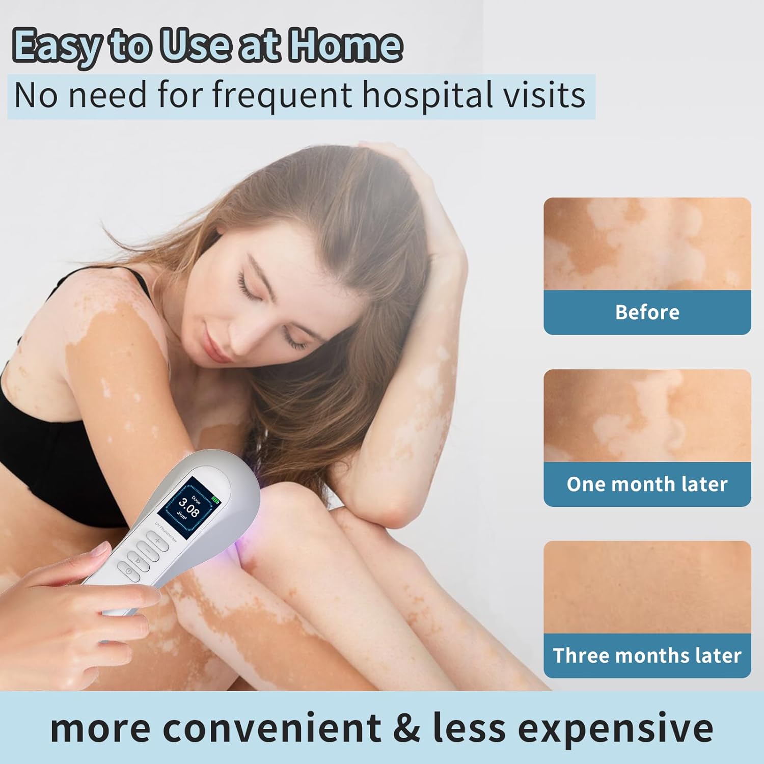 At Home 308 UV LED Lamp For Personal Home Use Device