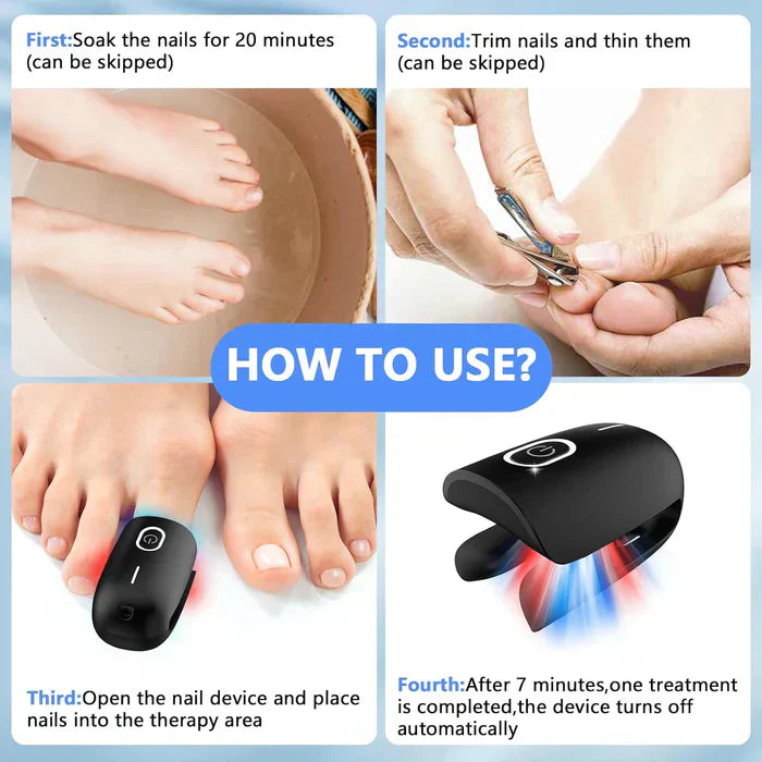 Toenail Fungus Laser Nail Care Device For Home Use