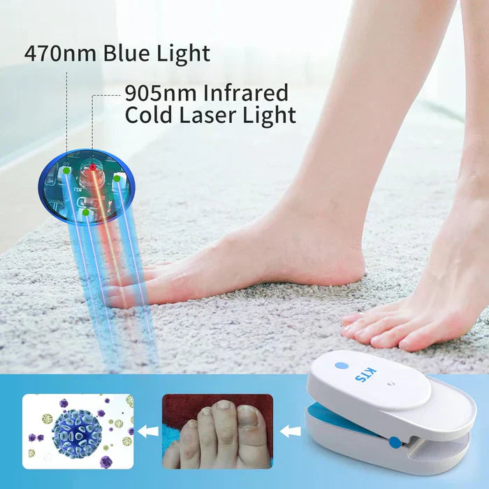 Kit laser per la salute delle unghie a casa di NovaPulse con due unità