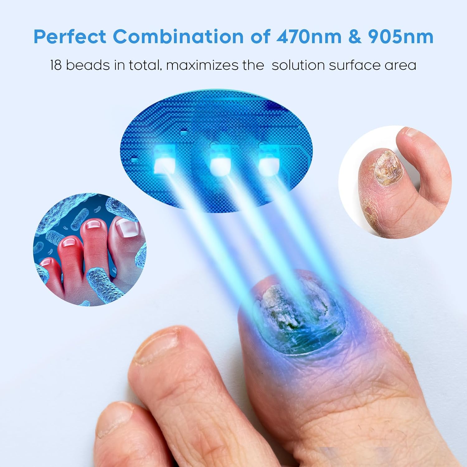 Nail Fungus Light for Multiple Toenails