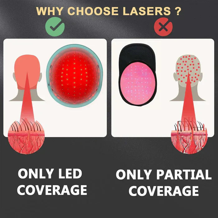 Device For Scalp Care Using A Laser Cap To Help Follicles