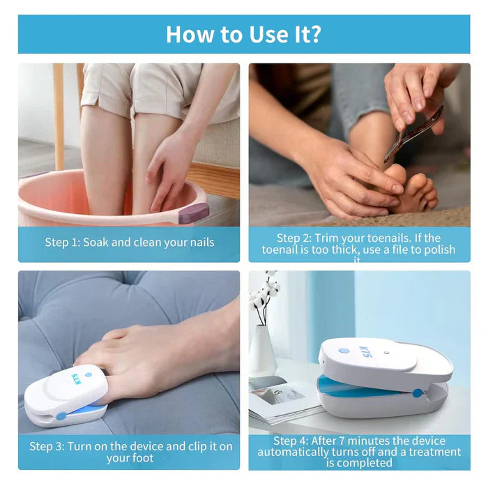 LuminNail Nail Fungus Laser System For Home Use And Care