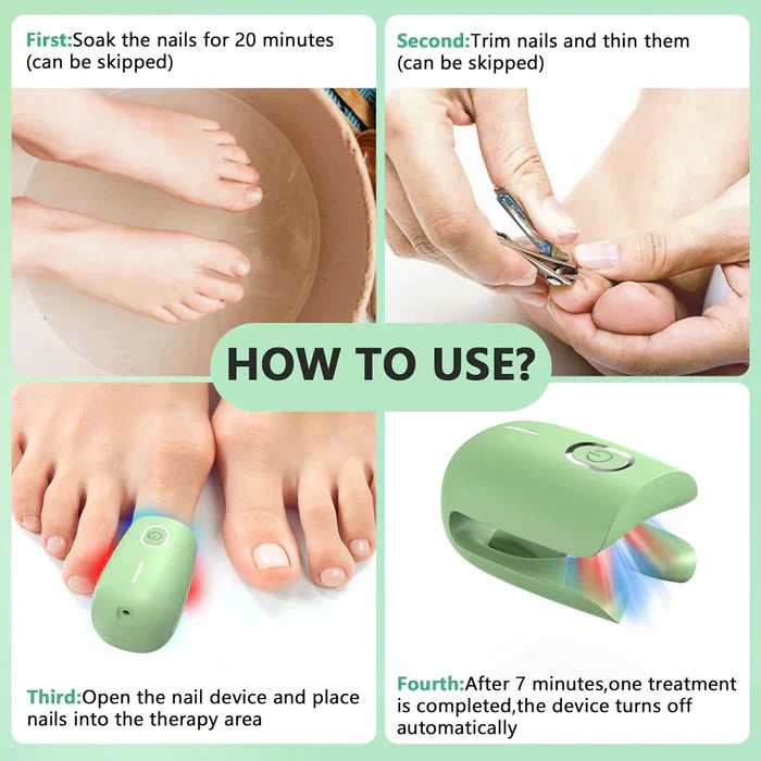 Toenail Fungus Laser Nail Care Device For Home Use