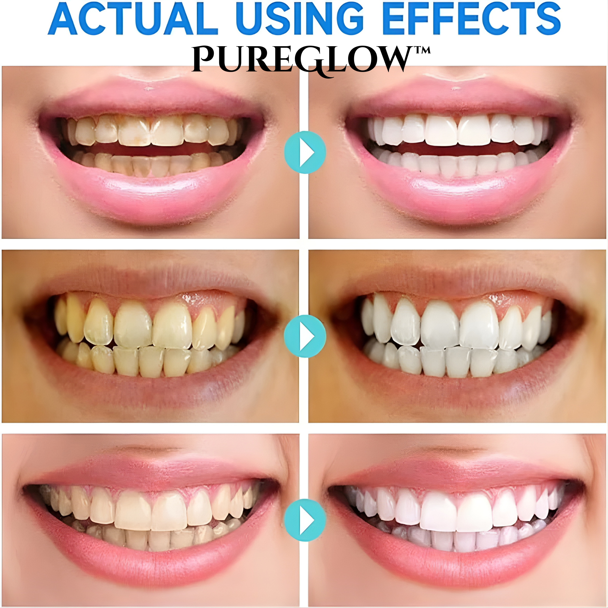 LumaBright Niacinamide Toothpaste For Quick Smile Brightening