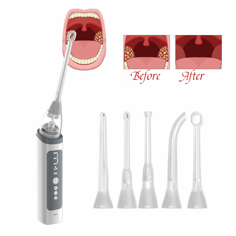 Home Use Kit For Removing Oral Debris Rinse Syringe Included