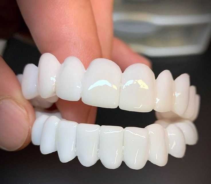 Tooth Replacement For Everyday Comfort And Confident Smiles