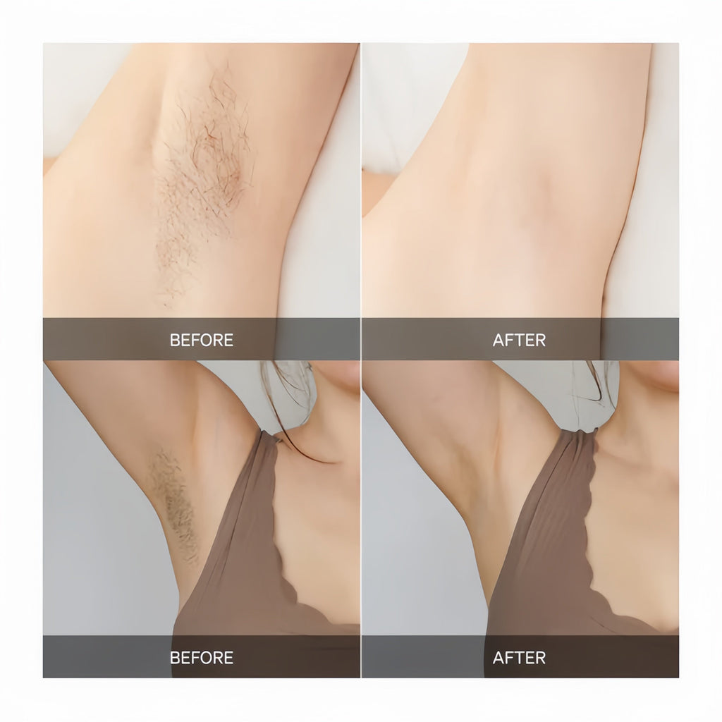 GlowPulse Hair Removal At Home Delivers Full Body Smoothness Without Irritation