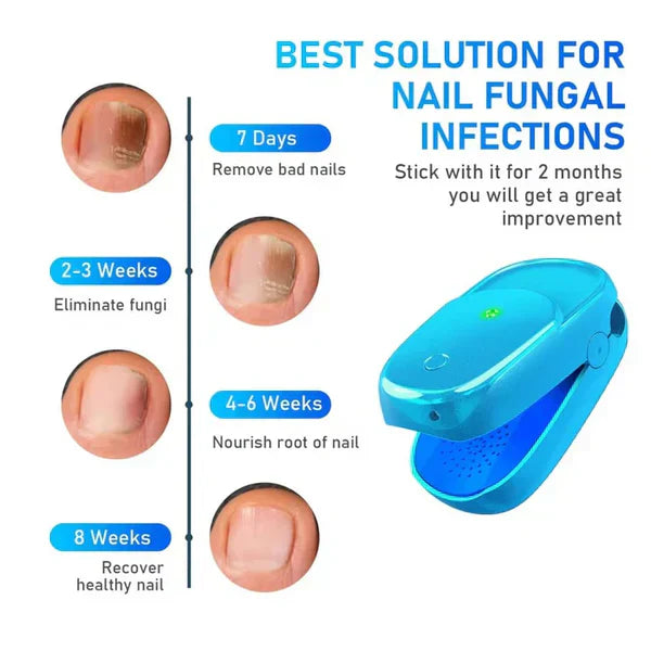 Dual-Wavelength Nail Laser Therapy Device For Nails On Hands And Feet