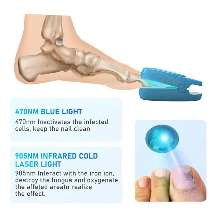 Dual-Wavelength Nail Laser Therapy Device For Nails On Hands And Feet
