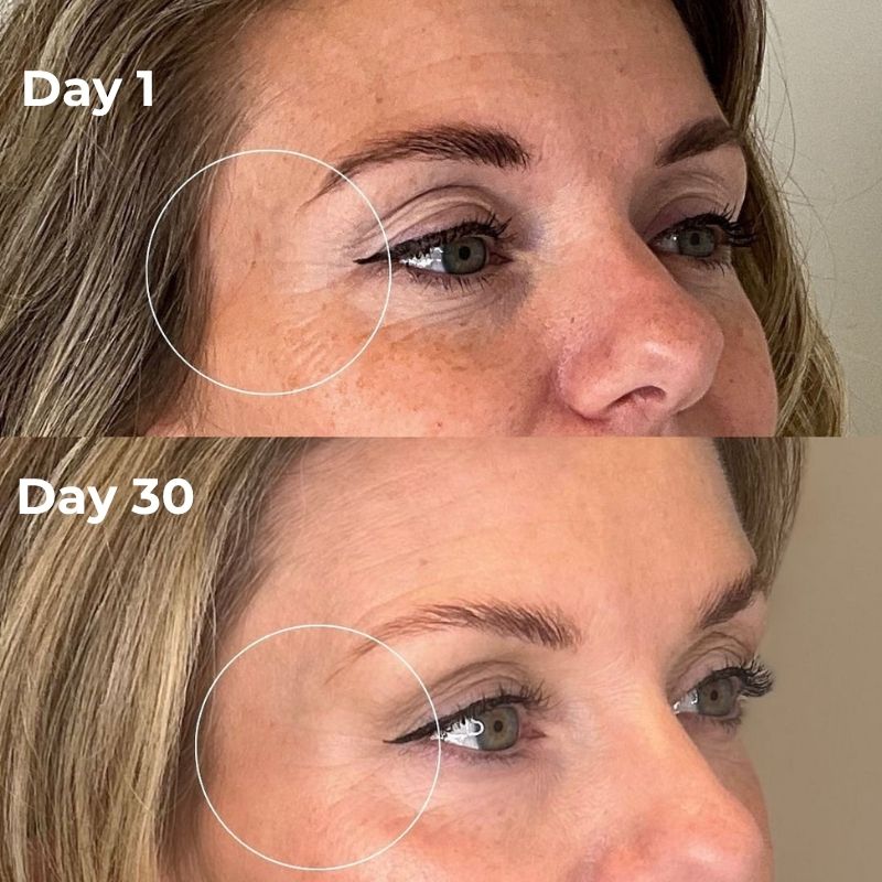 At-Home Under-Eye Red Light Therapy Device With Gentle Vibration