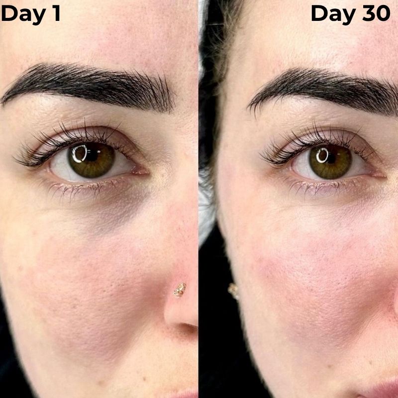 At-Home Under-Eye Red Light Therapy Device With Gentle Vibration