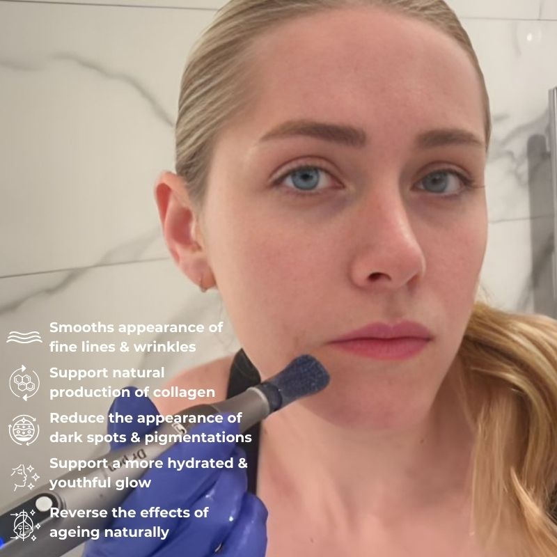 NovaDerm M8S At-Home Microneedling Pen For Skin Renewal