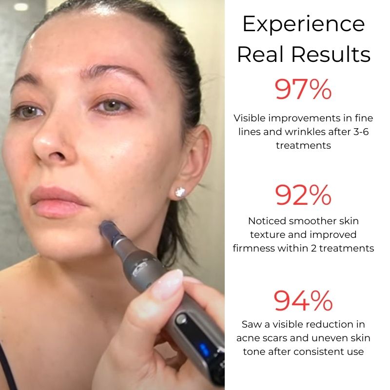 NovaDerm M8S At-Home Microneedling Pen For Skin Renewal