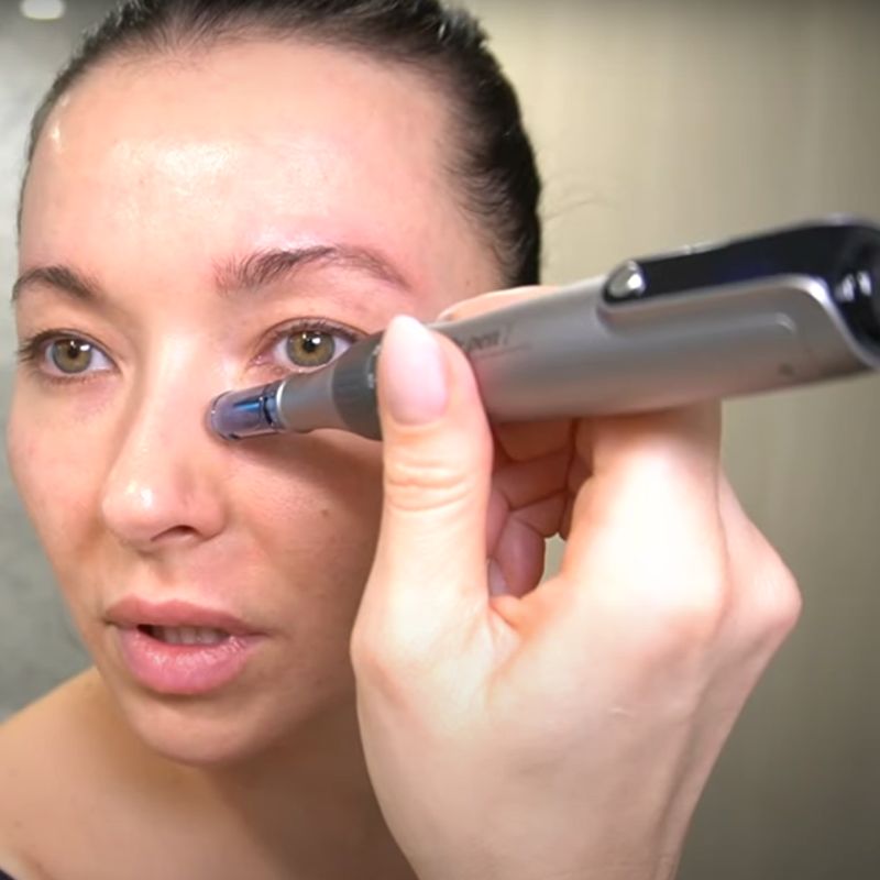 NovaDerm M8S At-Home Microneedling Pen For Skin Renewal