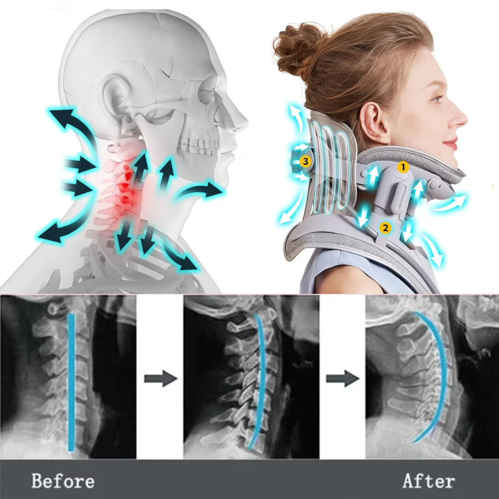 LuminaCerv Neck Relief Device For Daily Neck Comfort Plus Posture Support At Home