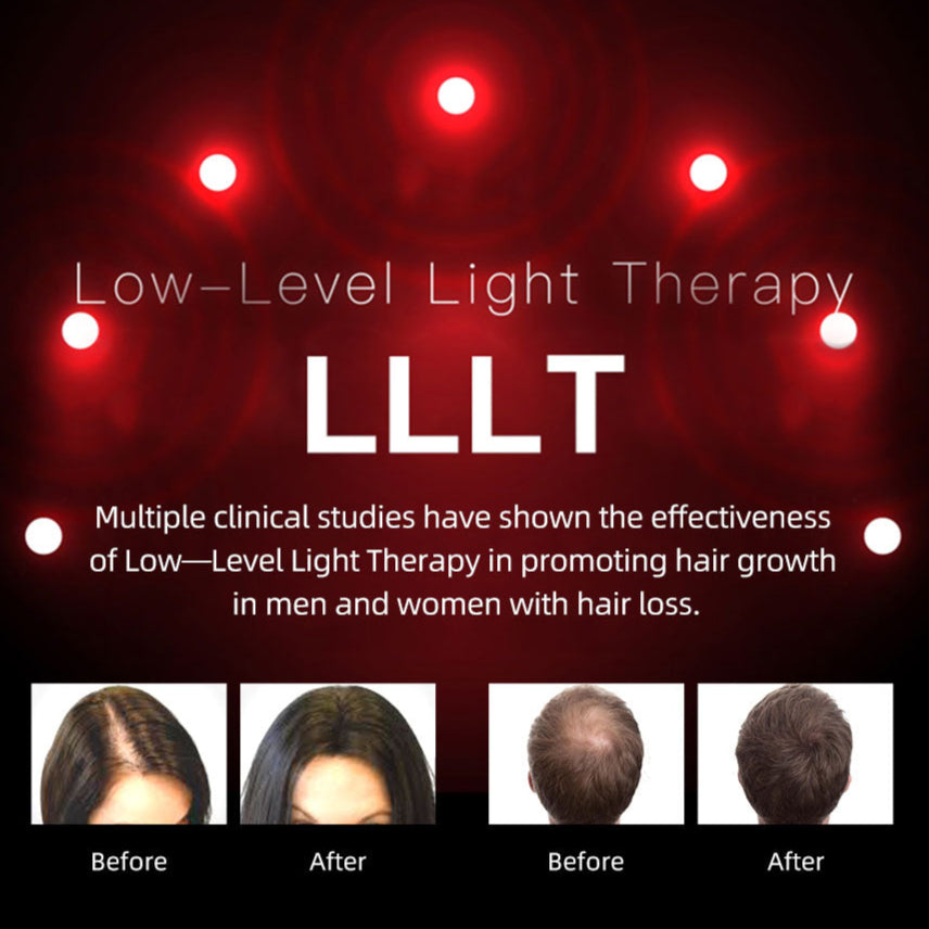 NovaFollicle LED Growth Helmet For Hair Regrowth Device