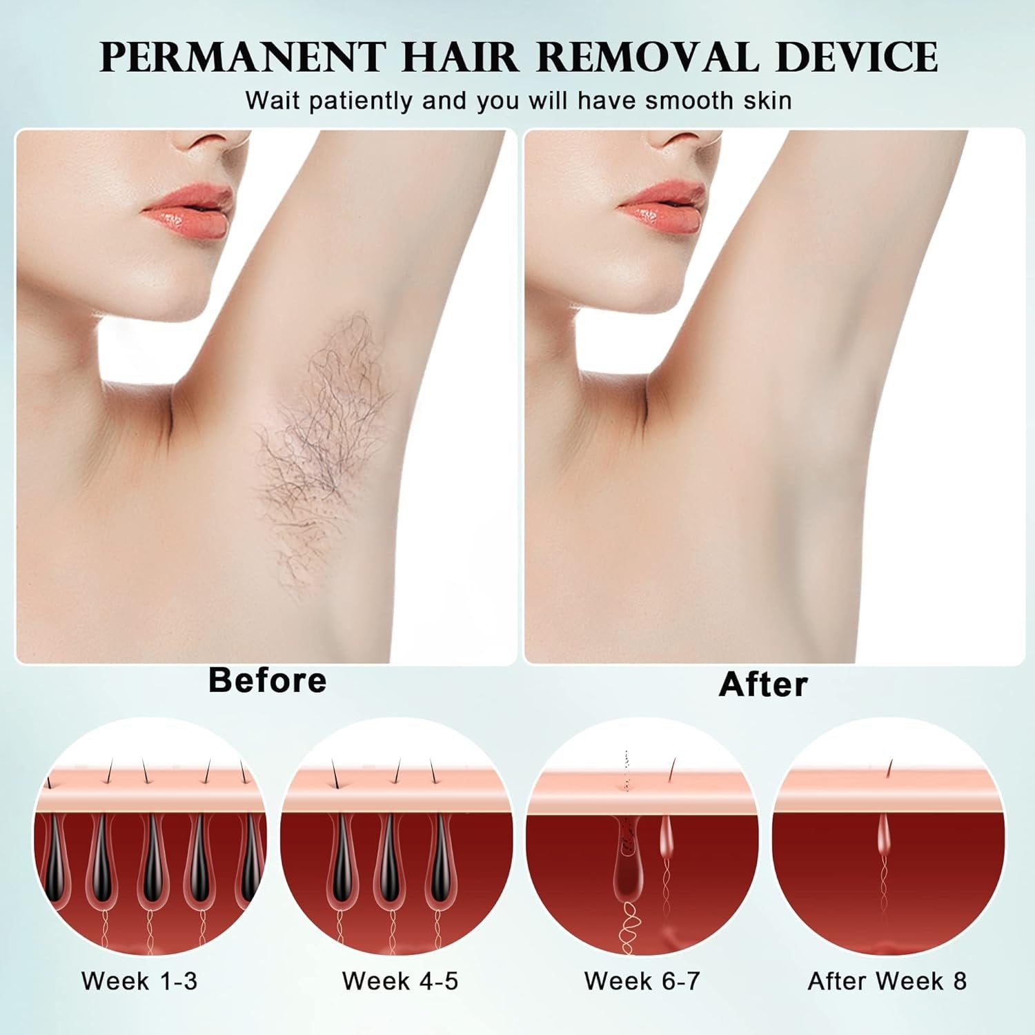 LumaDerm All In One At Home IPL System For Hair Removal And Skin Renewal
