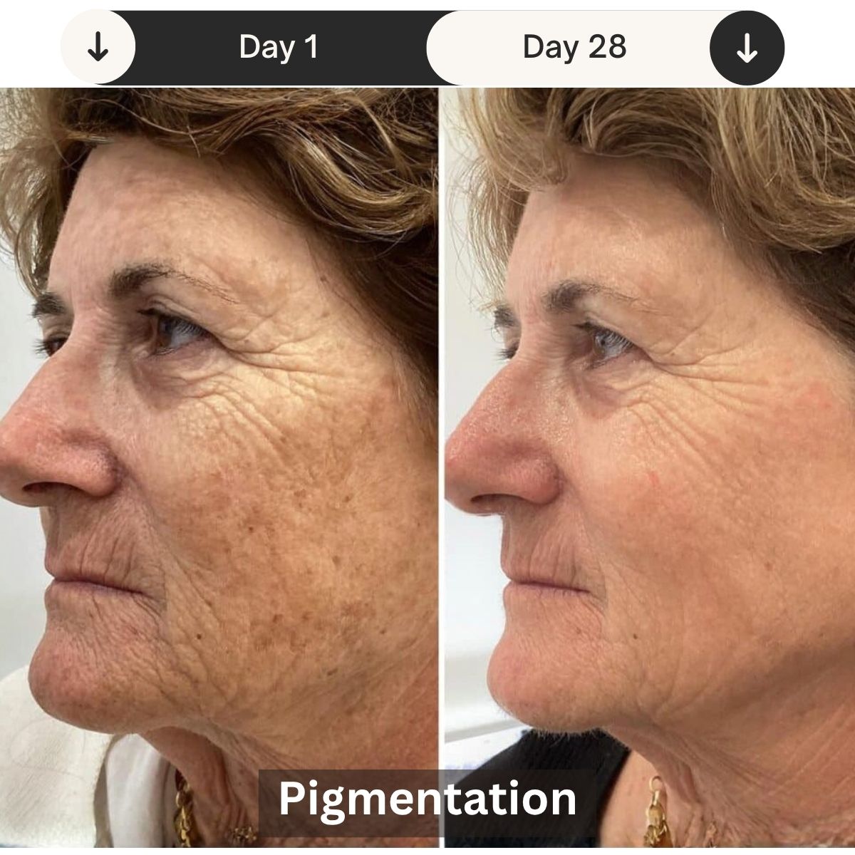 LED Skin Rejuvenation Device For Clinic And Home Use