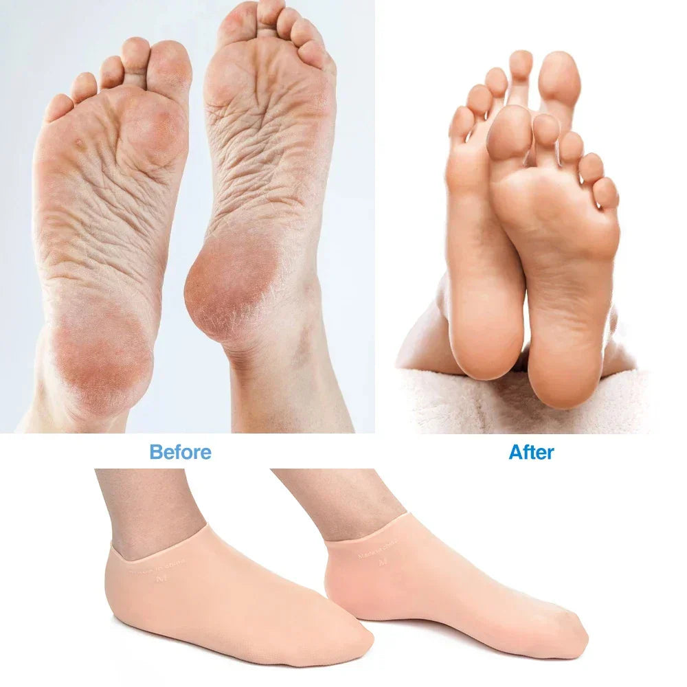 Calcetines de silicona para tracción en la playa y deportes acuáticos en terrenos rocosos
