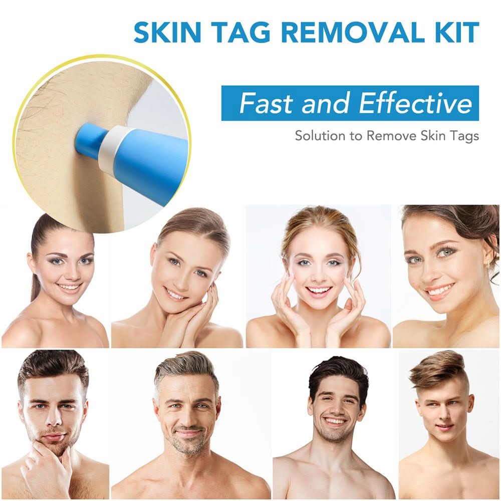 Ihonluomien Poistaja TagAway Kiputon Kotikäyttöön Kaulalle, Selälle ja Vartalolle