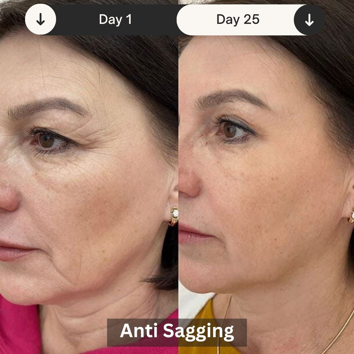 LED Skin Rejuvenation Device For Clinic And Home Use