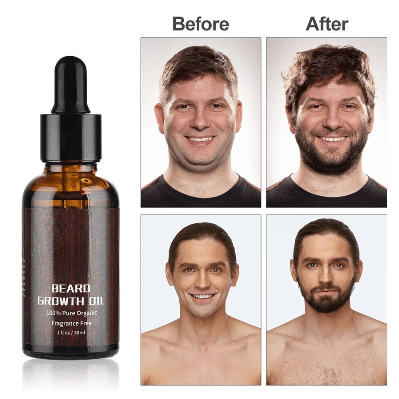 Kit BeardVibe para el Crecimiento de Barba en Zonas Irregulares y para un Crecimiento Saludable de la Barba